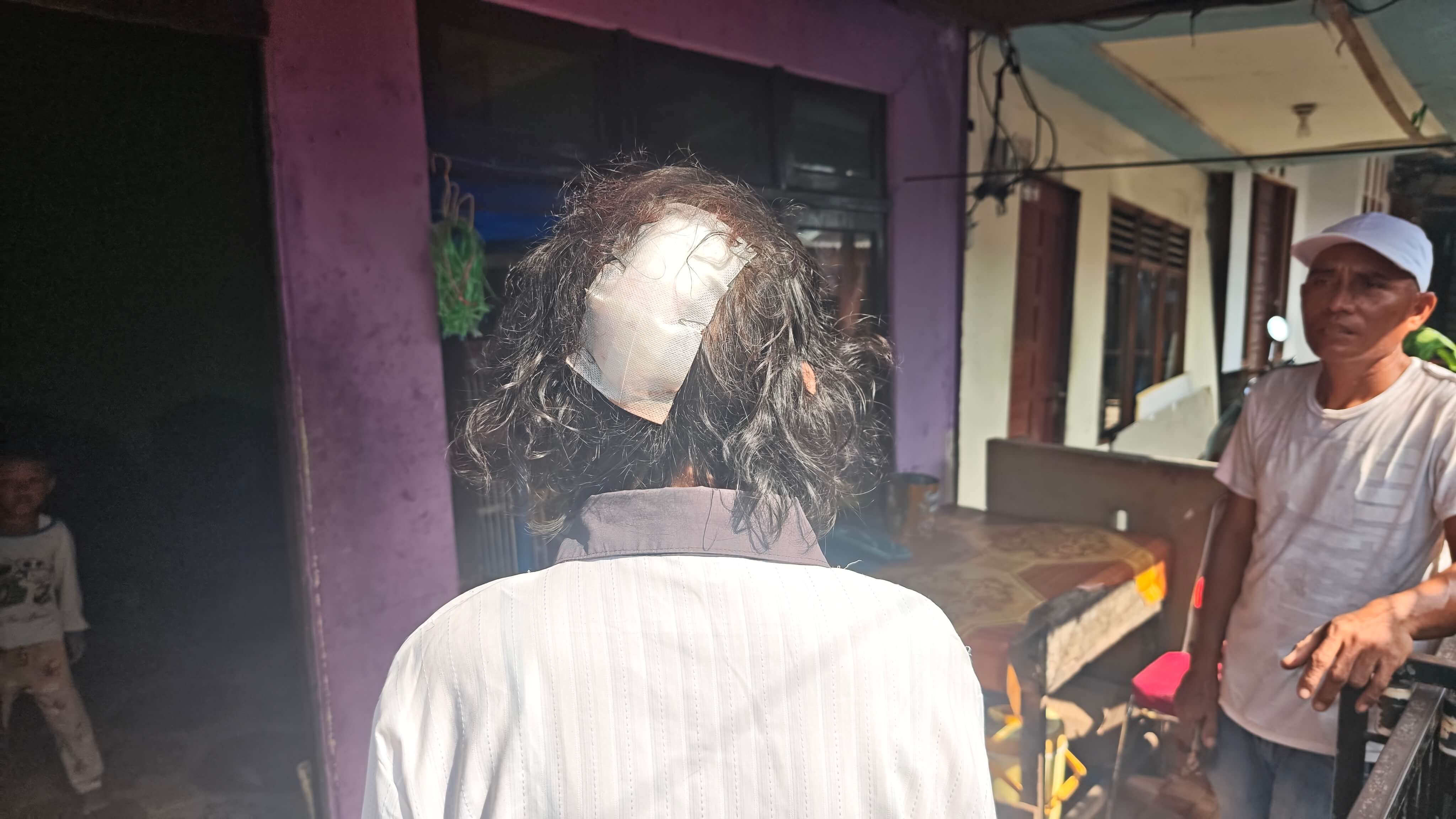Korban Gigitan Monyet Liar di Tembilahan